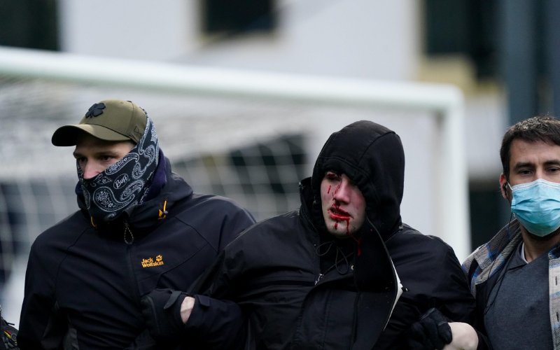 Buitenlandse pers spuwt Belgisch voetbal uit na zware incidenten