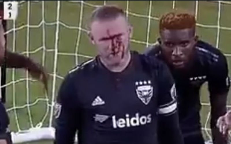 Wayne Rooney loopt verschrikkelijke blessure op