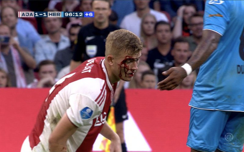 Ajax-speler De Ligt loopt vreselijke blessure op, zijn reactie is geweldig