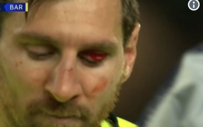 Vreselijke beelden van Messi in Champions League (VIDEO)